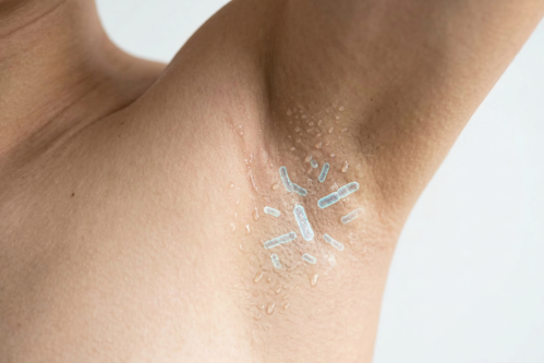 細菌のいる男性の脇